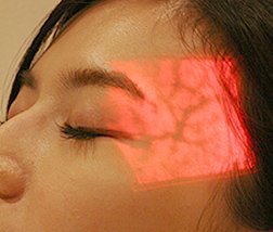 静脈可視化装置