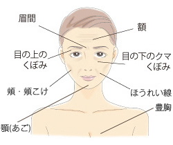 ヒアルロン酸注入が効果的です