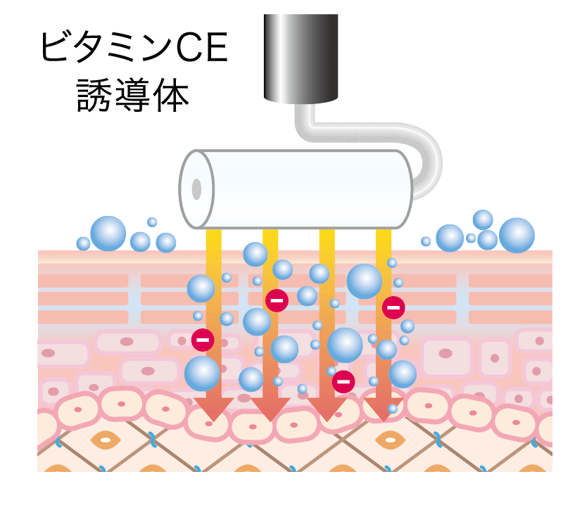 イオン導入