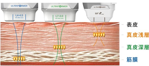 「真皮層」「脂肪層」「筋膜（SMAS）」